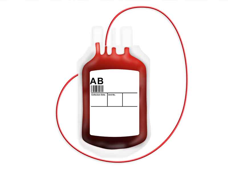 Compounding systems for PVC-P - application in a blood bag as an example